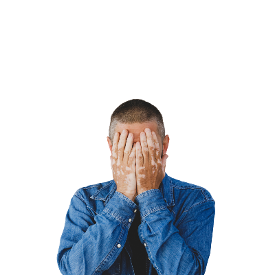 Vitiligo Nedir? Belirtileri ve Tedavi Yöntemleri Nelerdir?