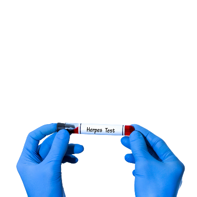 Uçuk Nasıl Geçer?