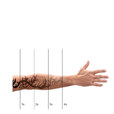 Dövme Sildirme Sonrası Nelere Dikkat Edilmelidir?