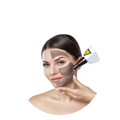 Karbon Peeling Nedir? Faydaları Nelerdir?