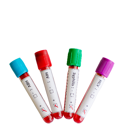 Cinsel Yolla Bulaşan Hastalıklar Nelerdir?